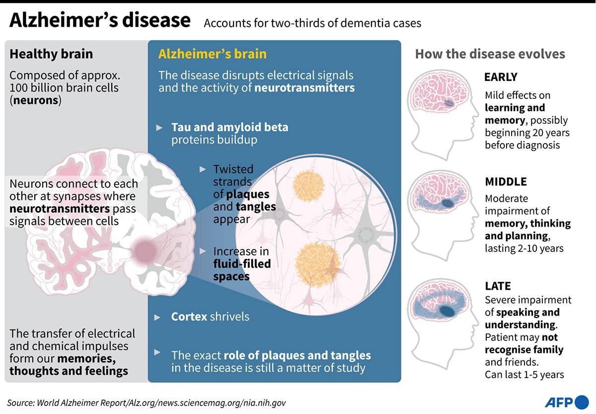 Alzheimer's Drug Slows Cognitive Decline | The Manila Times