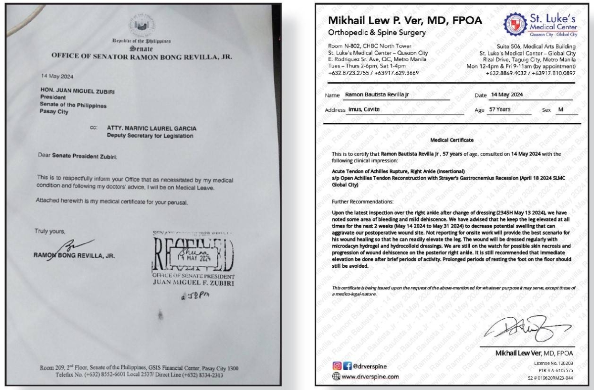 By May 14, the actor-senator was forced to file for a leave of absence (left)
from the Senate after his doctor found complications following the April 18
surgery on his Achilles tendon as detailed in this medical certificate (right).