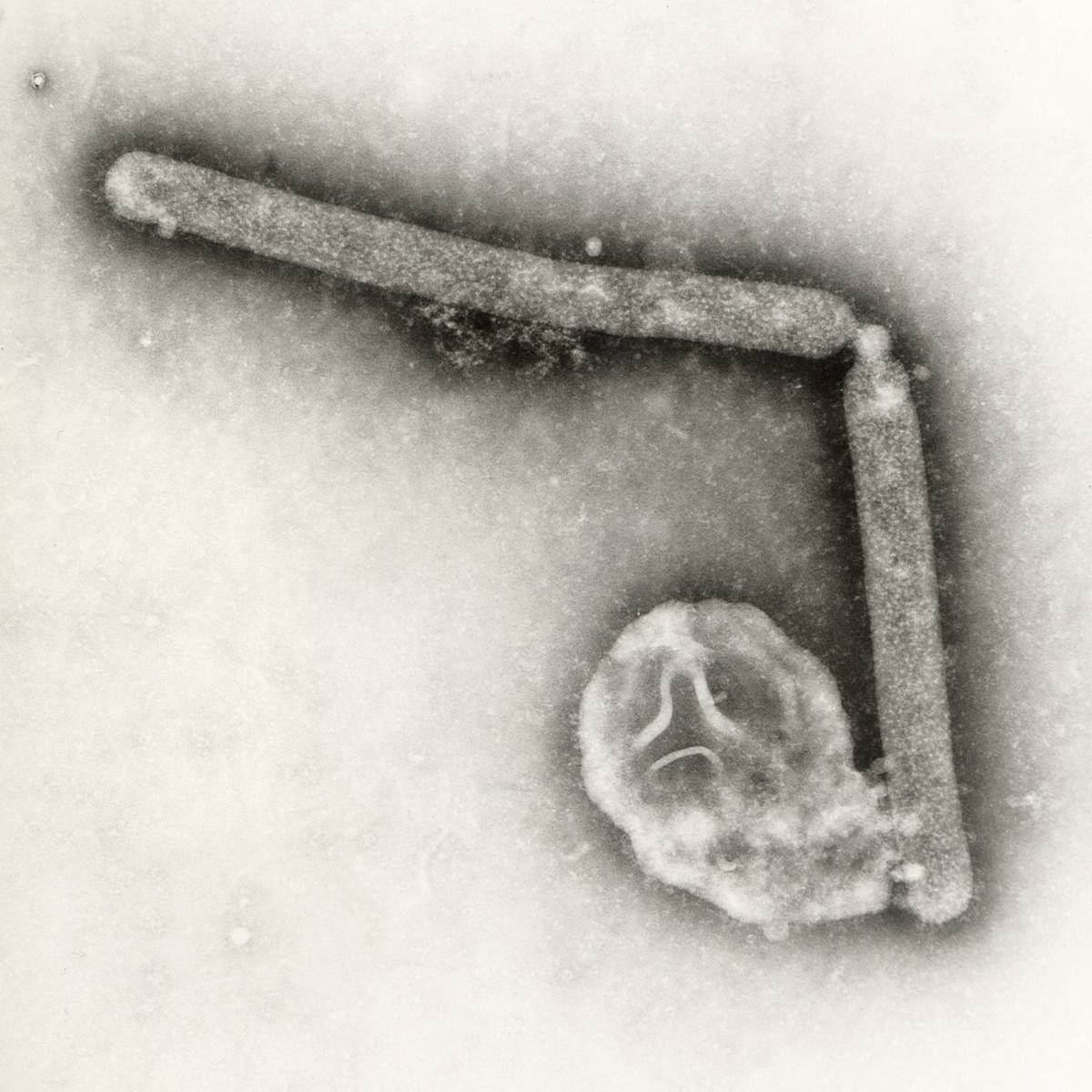 This undated electron microscopic image provided by the Centers for Disease Control and Prevention shows two Influenza A (H5N1) virions, a type of bird flu virus. PHOTO BY CYNTHA GOLDSMITH, JACKIE KATZ/ CDC VIA AP 