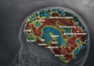 Shabu users develop severe disruptions in the production of BDNF protein leading to brain damage